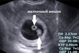 Не могат ли да видят бременност на ултразвук Какво гледат на ултразвук