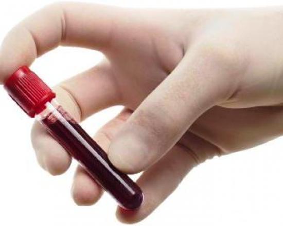 Nivel redus de trombocite în sânge Trombocitele 120 la femei ce înseamnă