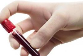 Trombotsüütide taseme langus veres Trombotsüüdid 120 naistel mida see tähendab