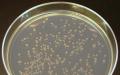 ეშერიხია (E. coli): მახასიათებლები, სიმპტომები, ტესტები, მკურნალობა