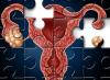 Pengobatan malformasi ovarium