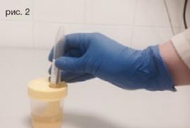 Cum să faci un test general de urină și ce arată acesta?