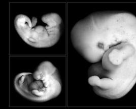 ორსულობის რომელ ეტაპზე და რომელ hCG-ზე ჩანს ემბრიონი: კვლევის სანდოობა პირველ კვირებში ემბრიონი არ ჩანს 7 კვირის მიზეზების გამო.