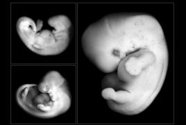 At what gestational age and at what hCG is the embryo visible: the reliability of the study in the first weeks The embryo is not visible at 7 weeks of the cause