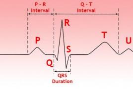 Doplňujúce informácie ku kapitole I Interval vnútornej odchýlky na EKG ako určiť