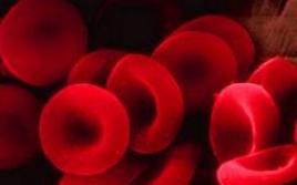 Diagnosi di laboratorio dell'anemia da carenza di ferro - test